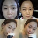 오슈마켓 | 오슈마켓 에르바이스 구입 후기