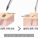 J헤어라인