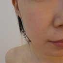 삼송 일산 피부관리 쏠에스테틱 수분 폭탄 생잎 알로에 관리 추천 후기