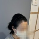 S헤어라인