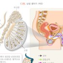 고환염 , 부고환염 (왼쪽 고환 통증, 음낭 부종, 발열) 이미지