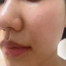 다움환경 | 송파피부관리 보라다움 내돈내산 문정 최초 비용기기 합법 레이저 솔직후기