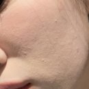 대치예스약국 | [피부 관리] 함익병 피부과 2차 방문 후기(피부사진 有)