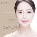 준성형외과 이미지