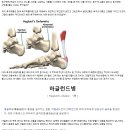 축구선수들이 축구화 뒤꿈치에 구멍을 뚫는 이유? 이미지