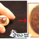 코리아의안센터 이미지