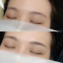 아인메디컬 이미지