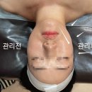 아미가 | 잠실역 입체윤곽관리 ‘아미가에스테틱‘ 재방문 후기(전/후 사진)