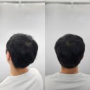 헤드샷스칼프SMP부산 이미지