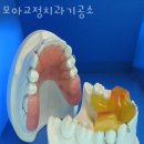 모아치과기공소 이미지