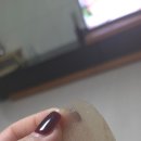 루비 | 1년 지나서 쓰는 루비레이저 후기｜기미·잡티, 정말 없어졌을까?