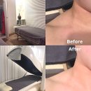 미인 | 목동 에스테틱 윤곽관리 미인본가 후기 | 작은 얼굴 관리, 승모근 변화까지