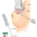 일산윌내과의원 네이버블로그