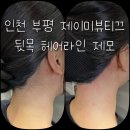 오루체 | 뒷목 헤어라인 제모 전후 / 제이미뷰티끄 인천 부평 본점 시술 후기 / 결혼 본식 관리