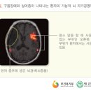 언어장애 이미지