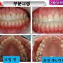 e-플랜트치과 이미지