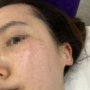 김영주피부미용 | 하안피부관리 예비신부 얼굴경락으로 관리하자 이수경 뷰티프라자