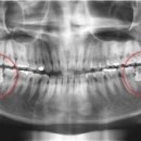 헬스사랑 이미지