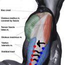 20140417 백스쿼트, 파트너와드 Mobility Recovery Position - Inner thigh, IT band(추가) 이미지