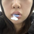 유디부천치과의원 | [부천양심치과]유디부천치과의원에서 충치치료받고온 후기