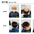 재구가발 네이버블로그