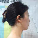 해피 뷰티 샵 | 방학동체형관리 해피트리뷰티샵 | 윤곽관리 받고 광대 줄어든 리얼 후기