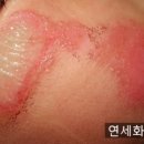 연세화산외과 이미지