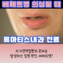 류마이준희내과의원, 베체트병 진단 필요하신가요? [베체트병 검사]