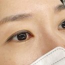 밀라뷰티 대구본점 이미지