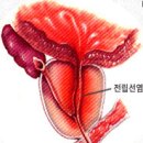 대구비뇨기과/대구멘파워비뇨기과 - 전립선염이란? 이미지