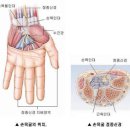 의학상식 -- 손발저림 이미지