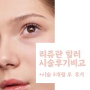 강남의원 | [내돈 내산] 리쥬란 힐러 후기 비교 - 강남 우유빛의원 vs 광명 XX의원