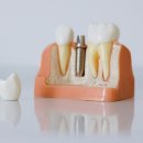 하이엔드 치과기공소 이미지