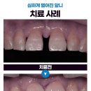 휴먼시아치과의원 이미지