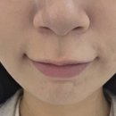 잘가요사랑니치과의원 이미지