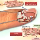 오닉스네일 이미지