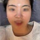 [위드비비드뷰티샵] 백설공주 케어✨ 후기 물광 피부 제대로 만들고 온 날 (봉선동 피부관리)