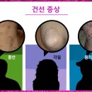 누가한의원 이미지