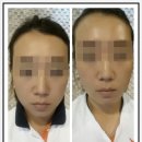 YM스킨갤러리