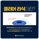 제이씨스마트기기 | 클리어라식 후기 체크해볼 점