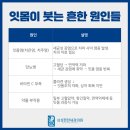 동대문서울삼성치과의원 네이버블로그