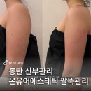 W.20. 동탄 신부관리 온유어에스테틱 팔뚝관리 후기 | 예약, 주차, 가격 총정리