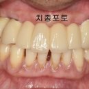 허브치과 이미지