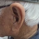 세종메디컬 | 세종보청기 3년 편측 사용 후, 반대편 추가 구매! 양이 착용 후기