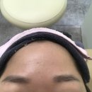 뷰티호텔 서동탄 파크 자이점 두피&amp;피부관리 시작