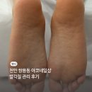 아코네일 이미지
