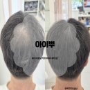 여수 탈모커버 잘하는 곳, 아이뿌 방문 후기