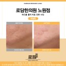 공릉한의원 | 공릉동 한의원 공릉역 피부과 여드름 피부관리 50대 흉터 새살침 치료 후기