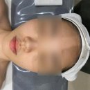 탑무인텔 | 광주 첨단 피부관리 ‘엘라올라’ 모공관리 후기