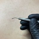 역리 | 마곡피부관리 약초필 바디필링 마곡역리숨에스테틱 후기